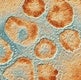 The New Coronavirus Outbreak: What We Know So Far